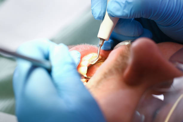 Best Emergency Treatment for Dental Infections or Abscesses in Copperas Cove, TX