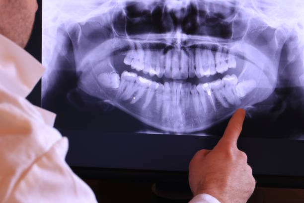Best Emergency Dental Care for Broken or Chipped Teeth in Copperas Cove, TX